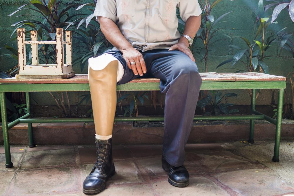 The photographer Sebastian Liste pictured this man, injured in the explosion of an anti-personnel mine during a military expedition in 1987, at the Furwus Capadife Rehabilitation Clinic in Managua, Nicaragua, in 2014